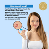 Skin Tag Removal Kit